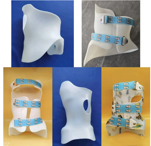 脊柱側(cè)彎支具