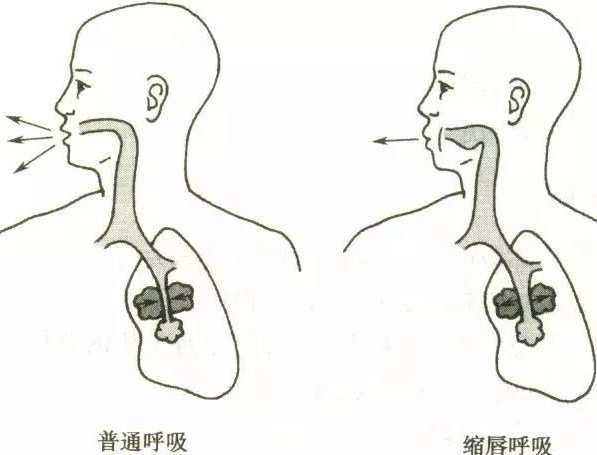 脊柱側彎的呼吸加支具